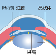 眼内镜示意图.png