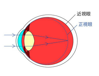 爱眼日如期而至，关注孩子眼睛健康，让他们拥有一个光明未来！