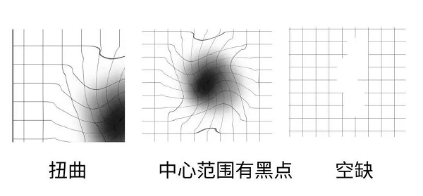 什么是黄斑变性？