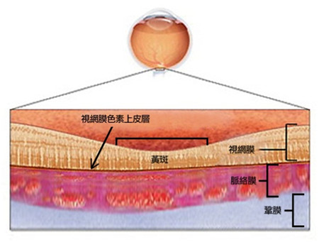 中浆发生原因