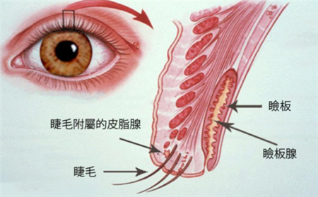 眼睑皮脂腺