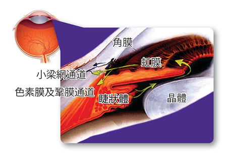 青光眼怎么治疗